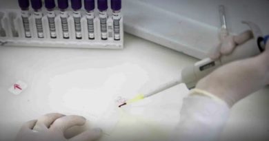 EXAMES DESCARTAM EBOLA EM IMIGRANTE DA REPÚBLICA DEMOCRÁTICA DO CONGO